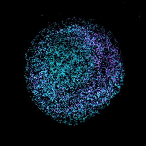 Brain organoids are self-assembled structures grown from pluripotent stem cells that model aspects of the developing human brain.