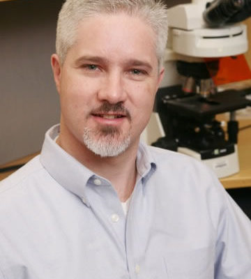Reward Function in Fragile X Syndrome Reward Function in Fragile X Syndrome