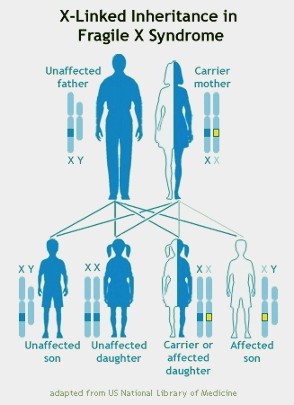 inheritance A mother who is a carrier of Fragile X has a 50% chance of passing the mutated gene on to each of her children.