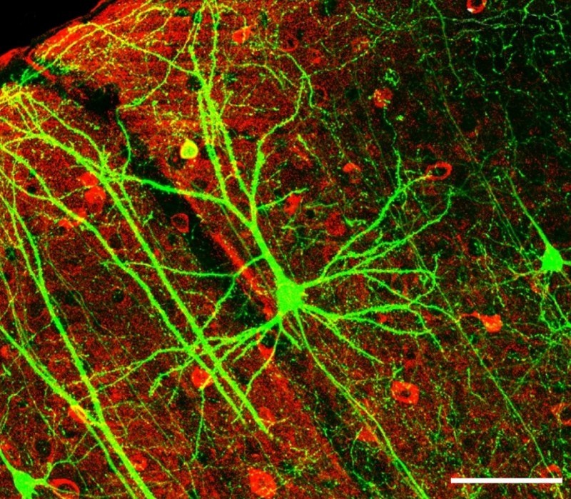 By Wei-Chung Allen Lee, Hayden Huang, Guoping Feng, Joshua R. Sanes, Emery N. Brown, Peter T. So, Elly Nedivi - Dynamic Remodeling of Dendritic Arbors in GABAergic Interneurons of Adult Visual Cortex. Lee WCA, Huang H, Feng G, Sanes JR, Brown EN, et al. PLoS Biology Vol. 4, No. 2, e29. doi:10.1371/journal.pbio.0040029, Figure 6f, slightly altered (plus scalebar, minus letter "f".), CC BY 2.5, https://commons.wikimedia.org/w/index.php?curid=3482256