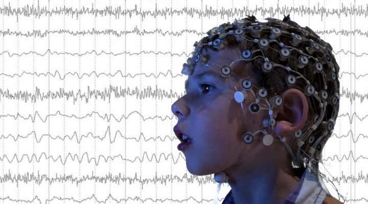 Recruiting: BRIDGE Study (BRain Indicators of Developmental Growth) Recruiting: BRIDGE Study (BRain Indicators of Developmental Growth)