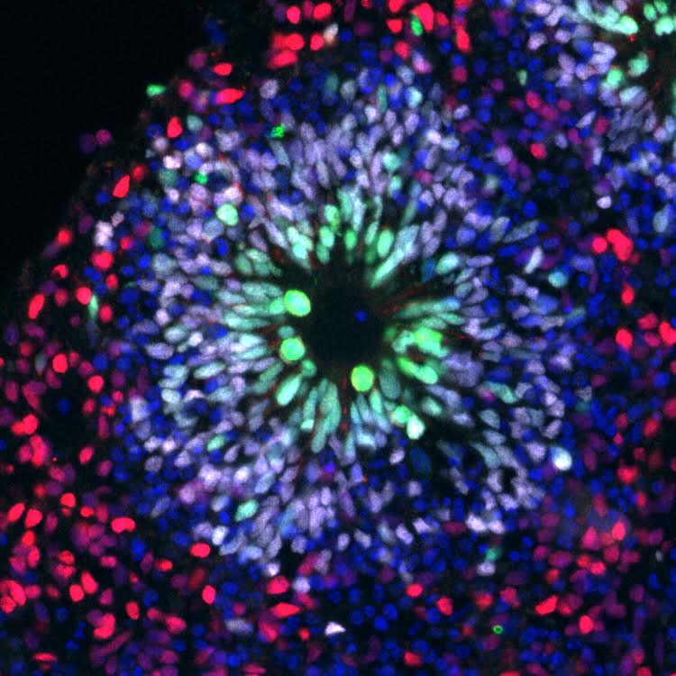 organoid