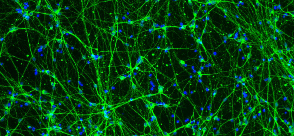 Human Neurons