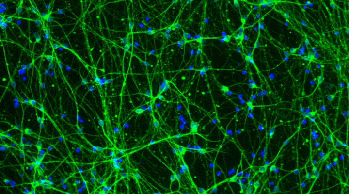 Retinoic Acid Signaling is Blocked by Fragile X Mutation Retinoic Acid Signaling is Blocked by Fragile X Mutation