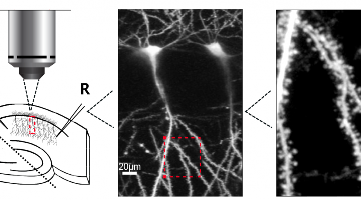 Enhancing NMDA Receptor Signaling to Treat Fragile X Syndrome Enhancing NMDA Receptor Signaling to Treat Fragile X Syndrome