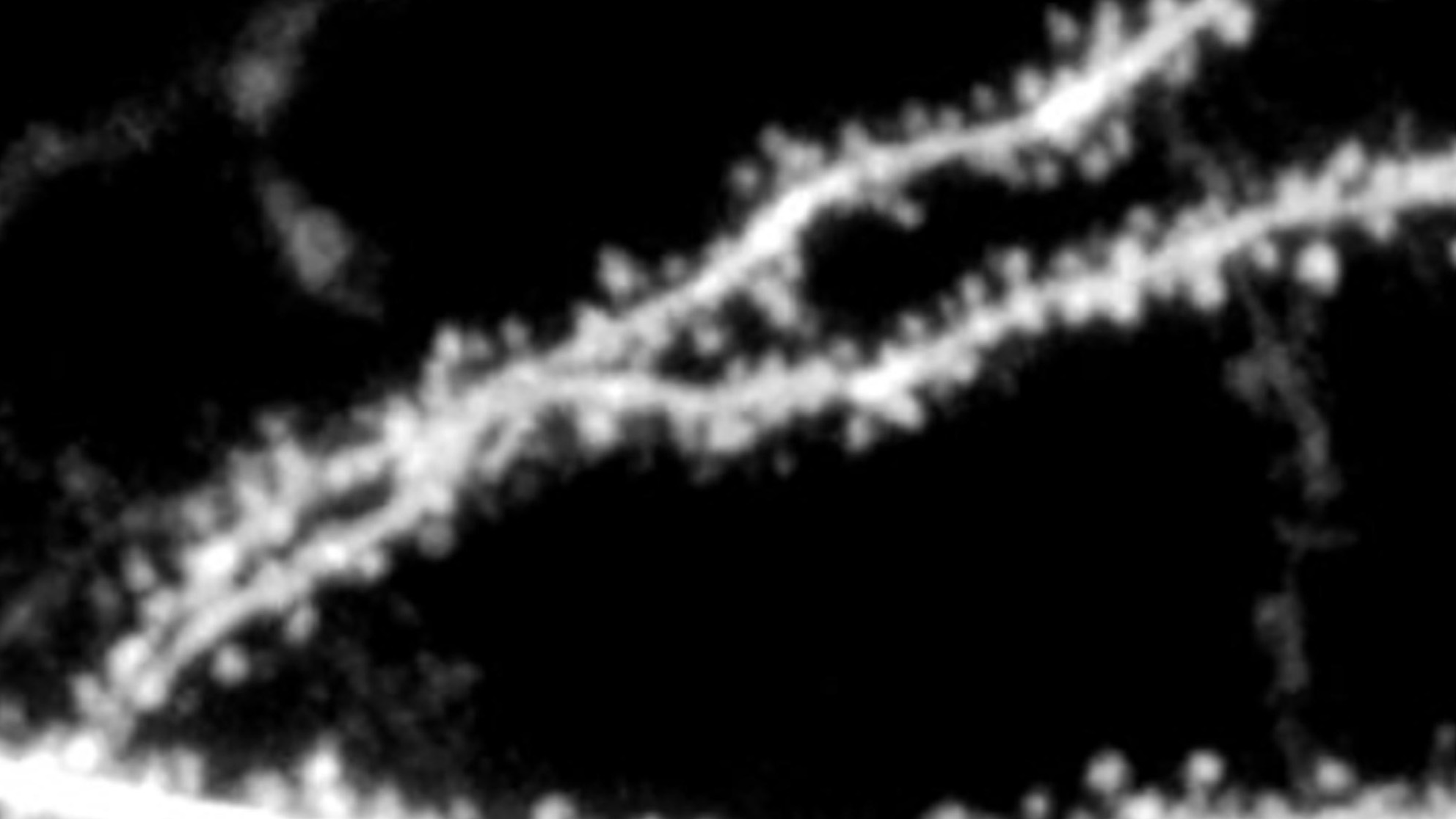 fragile-x-nmda-receptor-dendritic-spines-research High-resolution image of dendritic spines—tiny structures on neurons that are altered in Fragile X syndrome.