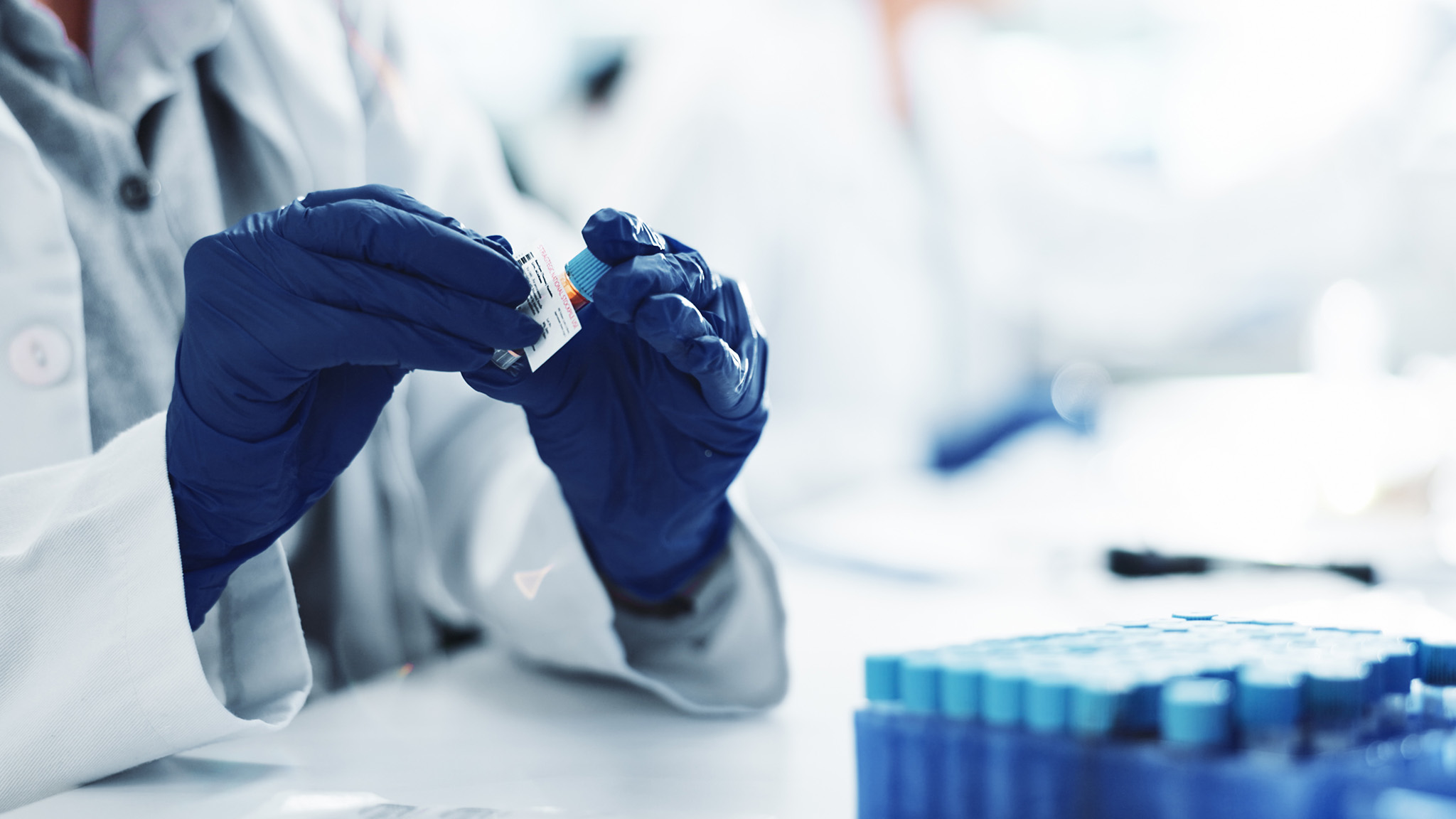 Fragile X Biomarker Research